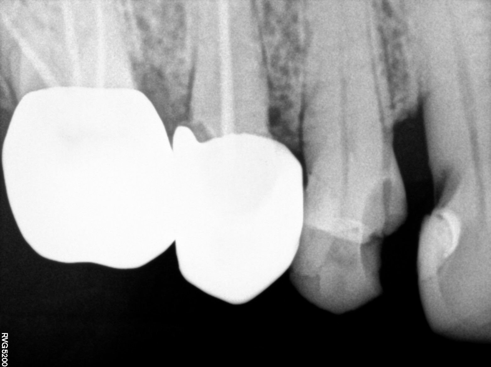 Dental X-ray